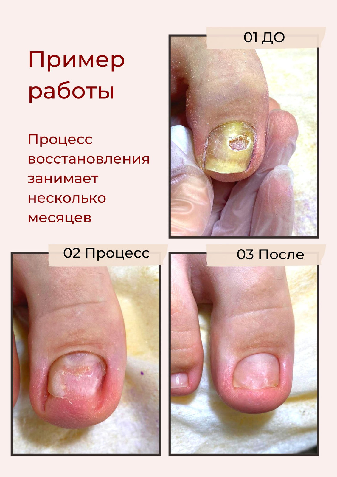 Подология